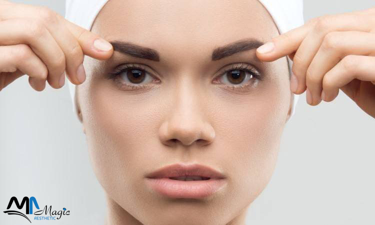 Implants à sourcils